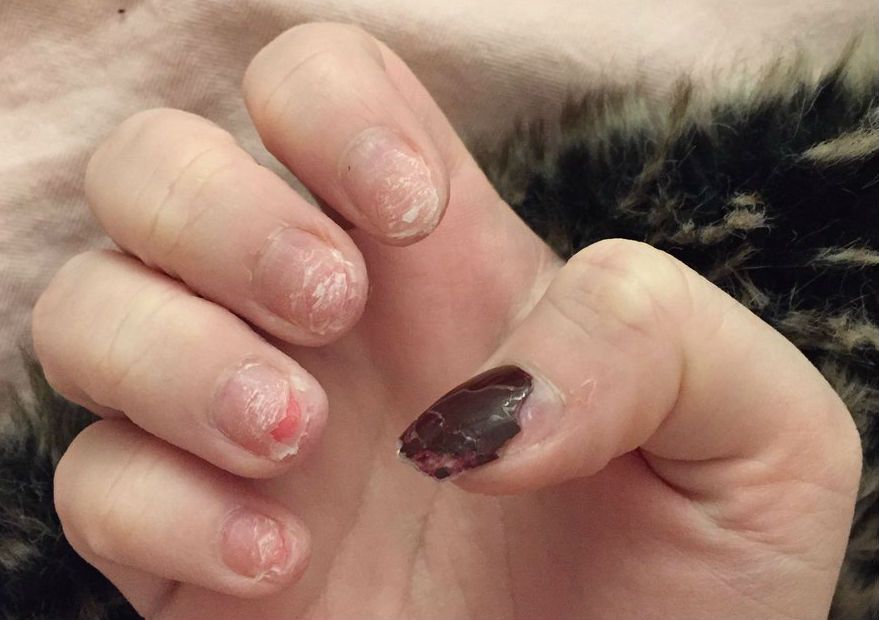 Are Acrylic Nails Bad for Your Nails? What About Gel?