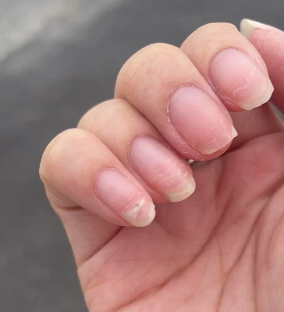 Is Gel or Acrylic Better for Weak Nails?