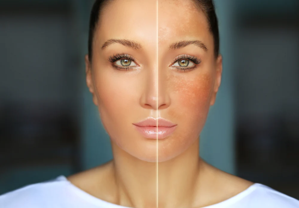 Common Skin Issues Color Correction Can Fix