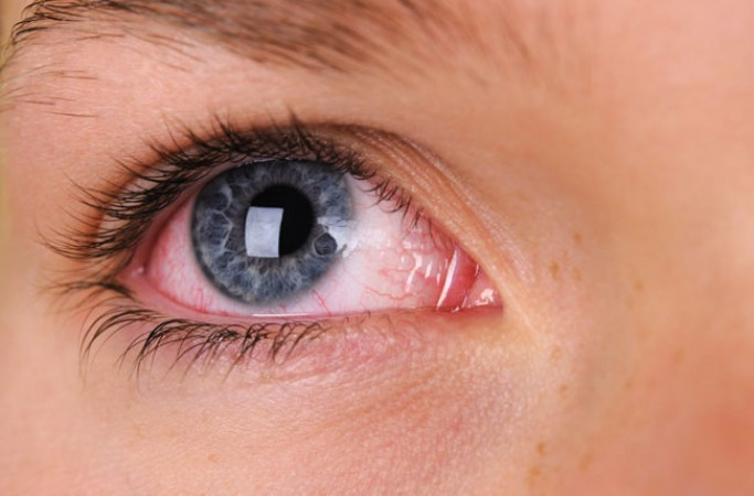 Myth 3 – Lash Lifts Are Unsafe for Everyone