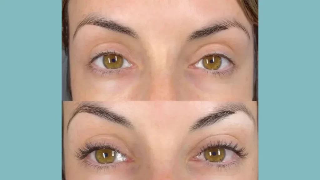What Happens During a Lash Lift?