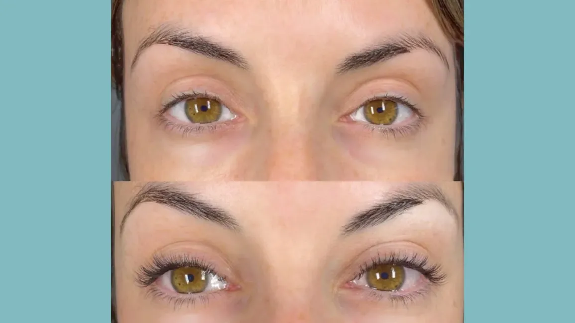 What Happens During a Lash Lift?