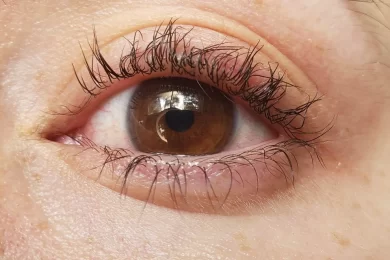 Do Lash Lifts Damage Your Lashes?